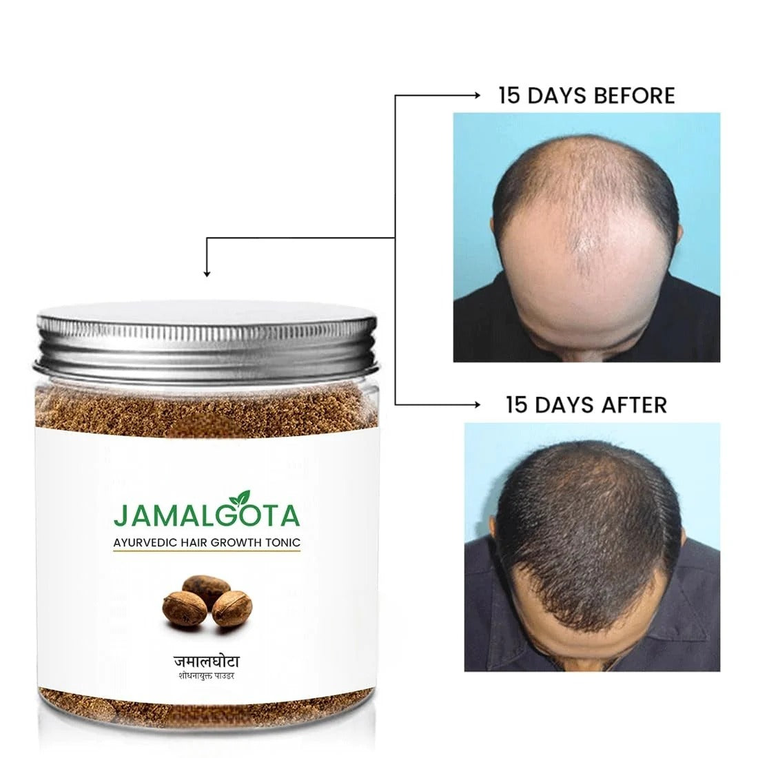 JAMALGATA Ayurvedic Hair Growth Tonic PACK OF 2